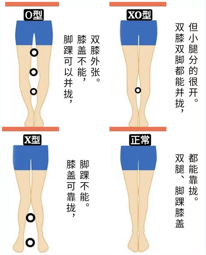 这个夏天你穿对裤子了吗？学会这样穿，让你显瘦又时髦